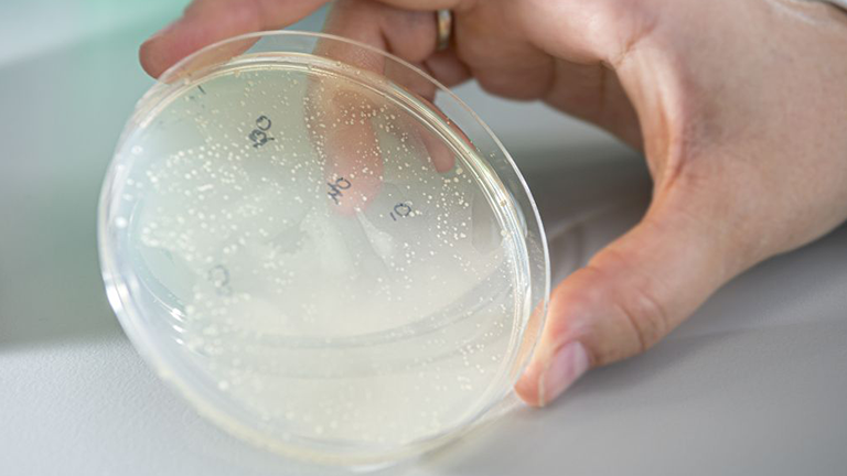 microorganism-ev-biotech